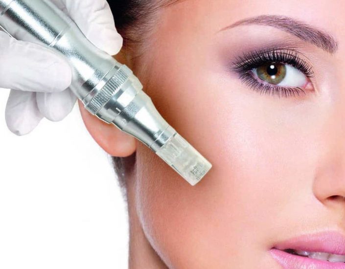 Microneedling Microneedling